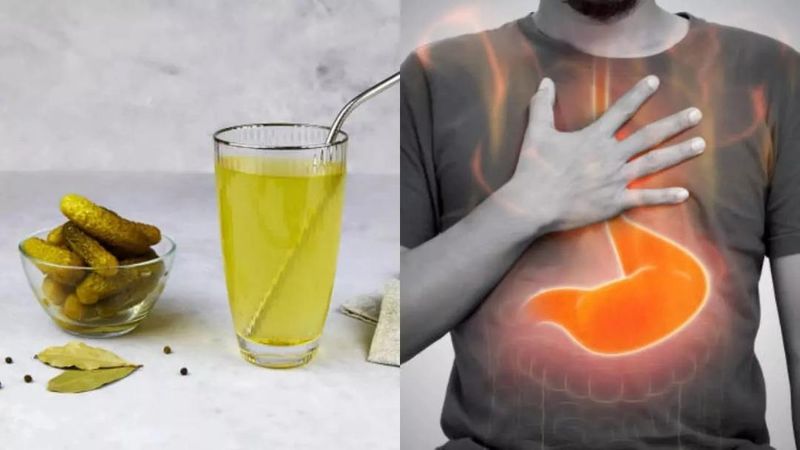 Acid Reflux Aggravator